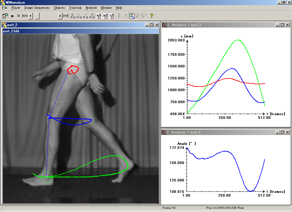 gait analysis